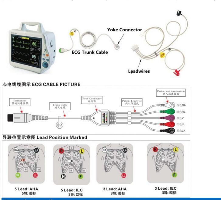 gambar ecg