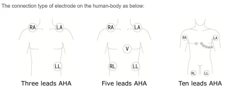 Bionet BM3 BM5 yang serasi satu bahagian kabel ECG dengan leadwires, AHA, 3-Lead, snap, 12pin merah